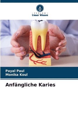Payal Paul, Monika Koul - Anfängliche Karies, Häftad