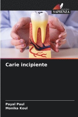 Carie incipiente 1