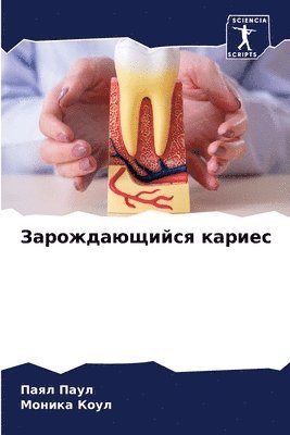 Паял Паул, Моника Коул, &#1055;&#1 &#1055;&#1072;&#1091;&#1083;, &#1052;&#1 &#1050;&#1086;&#1091;&#1083;, ¿¿¿¿ ¿¿¿¿, ¿¿¿¿¿¿ ¿¿¿¿ - Зарождающийся кариес, Häftad