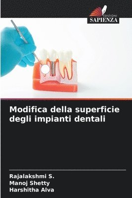 bokomslag Modifica della superficie degli impianti dentali