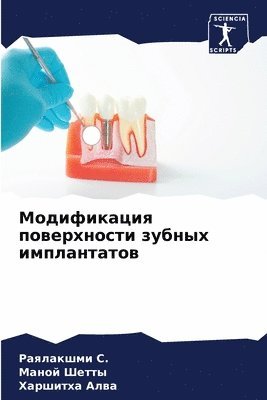 Модификация поверхности зубных импланта&