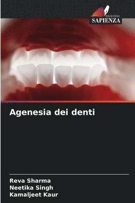 Agenesia dei denti 1