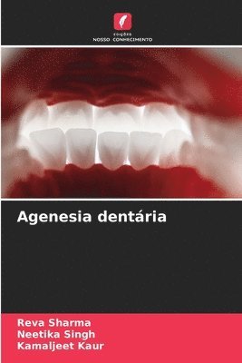 Agenesia dentria 1