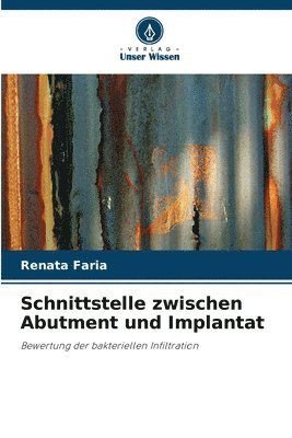 bokomslag Schnittstelle zwischen Abutment und Implantat