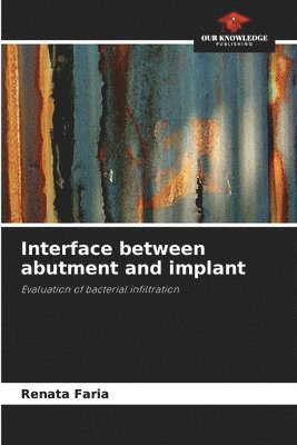 Renata Faria - Interface between abutment and implant, Häftad