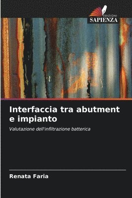 bokomslag Interfaccia tra abutment e impianto