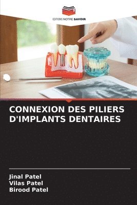 bokomslag Connexion Des Piliers d'Implants Dentaires