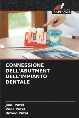 bokomslag Connessione Dell'abutment Dell'impianto Dentale