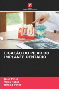 bokomslag Ligao Do Pilar Do Implante Dentrio