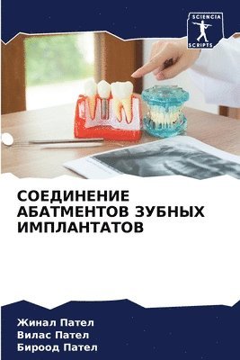 Жинал Пател, Вилас Пател, БИРООД ПАТЕЛ, &#1 &#1055;&#1072;&#1090;&#1077;&#1083;, ¿¿¿¿¿ ¿¿¿¿¿, Zhinal Patel, Vilas Patel - СОЕДИНЕНИЕ АБАТМЕНТОВ ЗУБНЫХ ИМПЛАНТАТО&, Häftad