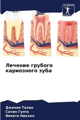 Джанви Талан, Сачин Гупта, Винета Никхил, &#1 &#1058;&#1072;&#1083;&#1072;&#1085;, &#1 &#1043;&#1091;&#1087;&#1090;&#1072;, ¿¿¿¿¿¿ ¿¿¿¿¿, ¿¿¿¿¿ ¿¿¿¿¿, Dzhanwi Talan - Лечение грубого кариозного зуба, Häftad