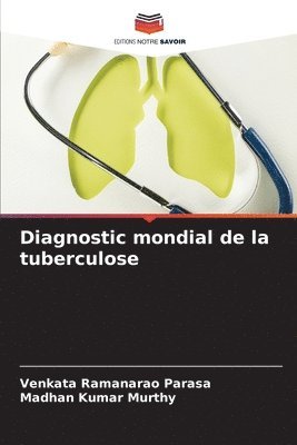 bokomslag Diagnostic mondial de la tuberculose