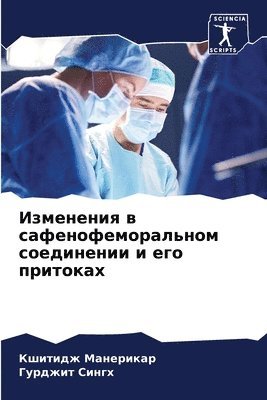 Изменения в сафенофеморальном соединени&