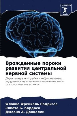 Врожденные пороки развития центральной н