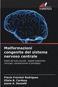 bokomslag Malformazioni congenite del sistema nervoso centrale