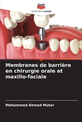 Membranes de barrire en chirurgie orale et maxillo-faciale 1