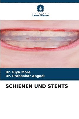 Riya More, Prabhakar Angadi, Dr. Riya More, Dr. Prabhakar Angadi - Schienen Und Stents, Häftad