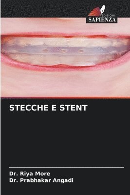 bokomslag Stecche E Stent