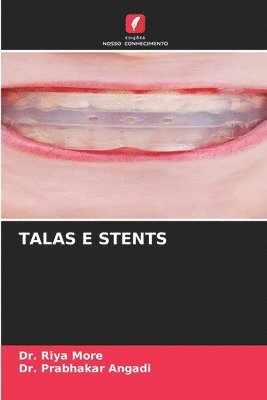 Talas E Stents 1