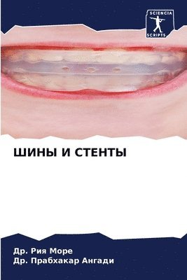 &#1044&#1088. Рия Море, &#1044&#1088. Прабхакар Ангади, &#1044&#10 &#1052;&#1086;&#1088;&#1077;, &#1040;&#1085;&#1075;&#1072;&#1076;&#108, ¿¿. ¿¿¿ ¿¿¿¿, ¿¿. ¿¿¿¿¿¿¿¿¿ ¿¿¿¿¿¿ - ШИНЫ И СТЕНТЫ, Häftad