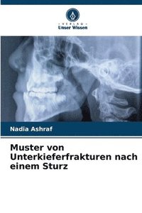 bokomslag Muster von Unterkieferfrakturen nach einem Sturz