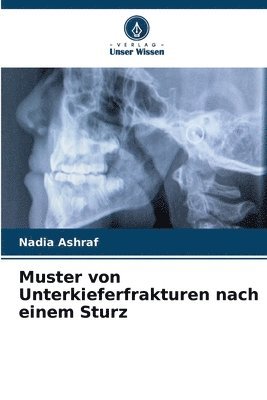 Muster von Unterkieferfrakturen nach einem Sturz 1