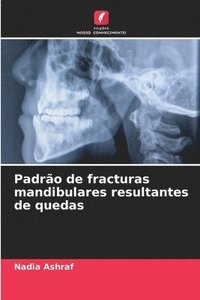 bokomslag Padro de fracturas mandibulares resultantes de quedas