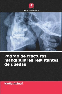 Padro de fracturas mandibulares resultantes de quedas 1