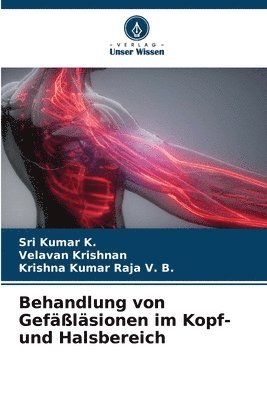 Sri Kumar K, Velavan Krishnan, Krishna Kumar Raja V B, Sri Kumar K., VELAVAN KRISHNAN, Krishna Kumar Raja V. B. - Behandlung von Gefäßläsionen im Kopf- und Halsbereich, Häftad