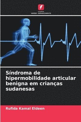 Sndroma de hipermobilidade articular benigna em crianas sudanesas 1