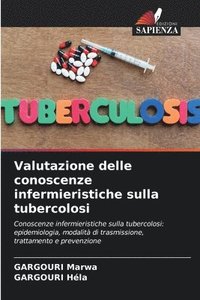 bokomslag Valutazione delle conoscenze infermieristiche sulla tubercolosi