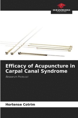 Efficacy of Acupuncture in Carpal Canal Syndrome 1