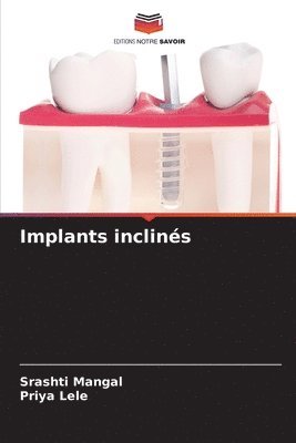 Srashti Mangal, Priya Lele - Implants inclinés, Häftad