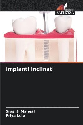 Srashti Mangal, Priya Lele - Impianti inclinati, Häftad