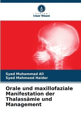 Orale und maxillofaziale Manifestation der Thalassmie und Management 1