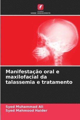 bokomslag Manifestao oral e maxilofacial da talassemia e tratamento