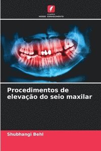 bokomslag Procedimentos de elevao do seio maxilar