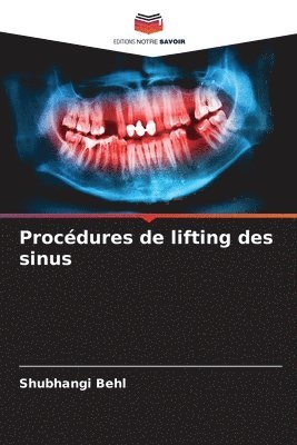 bokomslag Procdures de lifting des sinus