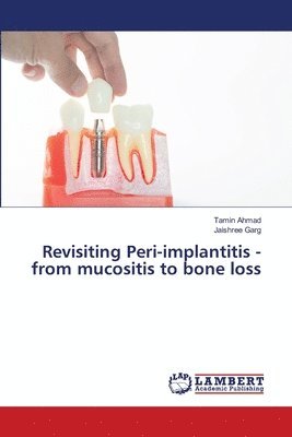 Tamin Ahmad, Jaishree Garg - Revisiting Peri-implantitis - from mucositis to bone loss, Häftad