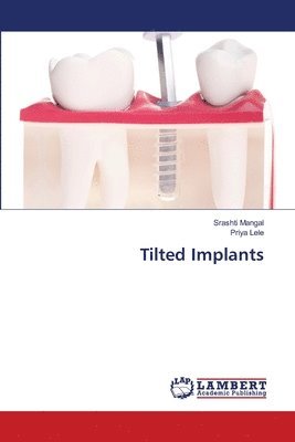 Srashti Mangal, Priya Lele - Tilted Implants, Häftad