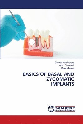 Ganesh Nandnavare, Anup Cholepatil, Maya Mhaske - Basics of Basal and Zygomatic Implants, Häftad