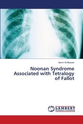 bokomslag Noonan Syndrome Associated with Tetralogy of Fallot