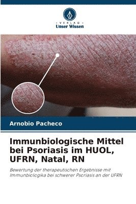 bokomslag Immunbiologische Mittel bei Psoriasis im HUOL, UFRN, Natal, RN