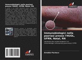 bokomslag Immunobiologici nella psoriasi presso l'HUOL, UFRN, Natal, RN