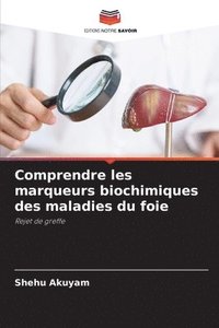 bokomslag Comprendre les marqueurs biochimiques des maladies du foie