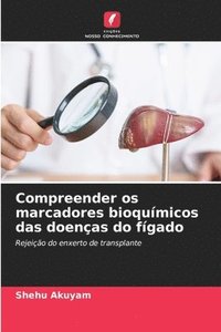 bokomslag Compreender os marcadores bioquímicos das doenças do fígado