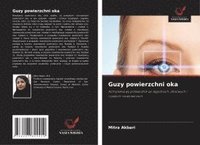 bokomslag Guzy powierzchni oka