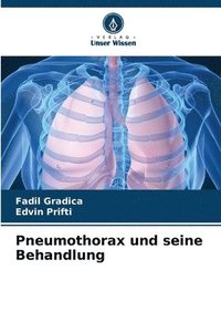 bokomslag Pneumothorax und seine Behandlung