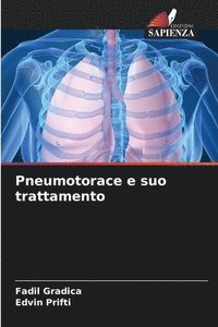 bokomslag Pneumotorace e suo trattamento