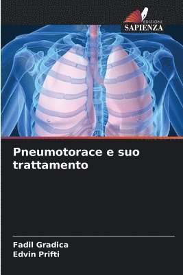 bokomslag Pneumotorace e suo trattamento